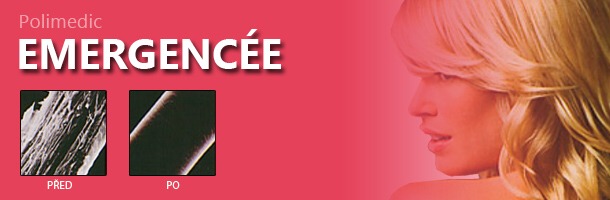 NEXXUS EMERGENCÉE - klinika pro ošetření vlasů